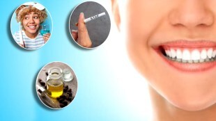 Healthy Gums