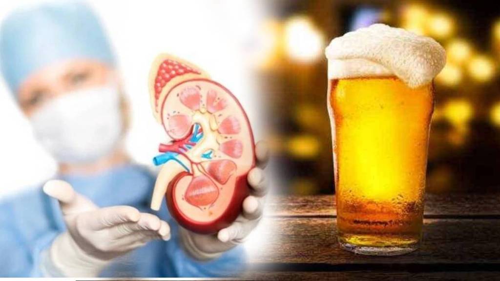 1 in 3 indians believe that beer consumption helps treat kidney stones