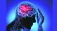 health stroke is big challenge for youths india suffering one stroke at every 40 second and one stroke death every 4 minute said aiims doctor