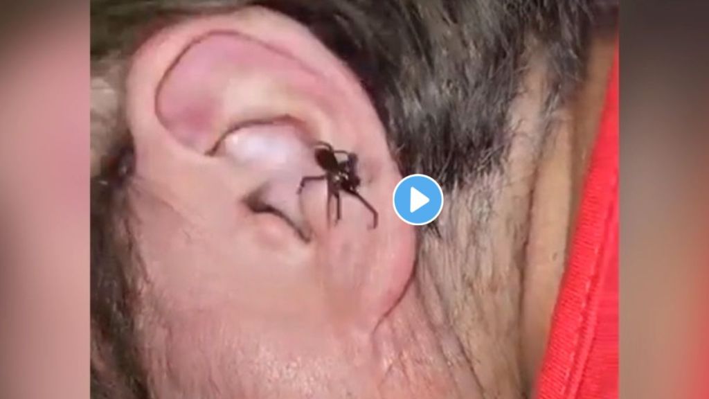 Spider Stuck In Mans Ear Video