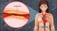 high cholesterol causes