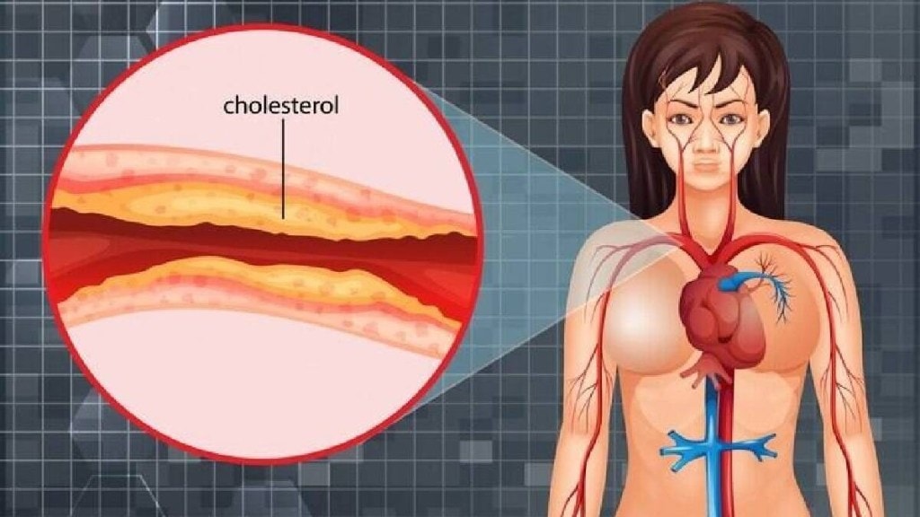 high cholesterol causes