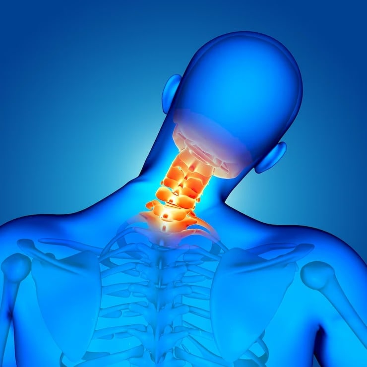 neck pain remedies