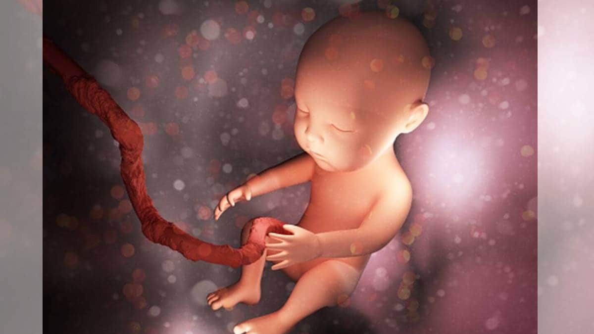 umbilical cord wrap around the babys neck due to the sleeping position of the pregnant woman read whats doctors said