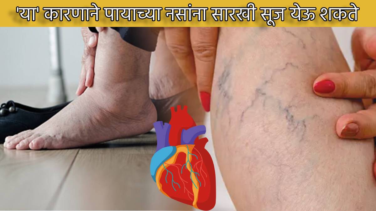 Swelling Veins In Legs Turning Dare Green and Blue Heart Gives These Signals Before Stop to Pumping Blood Health News