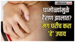 These home remedies will be beneficial to reduce the discomfort caused by sweating