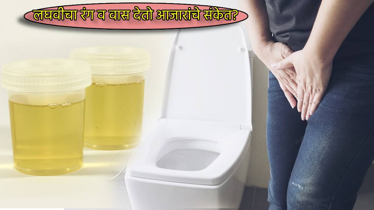 Why Pee Is Dark Yellow Orange Red and Smells Bad Spot These Signs Of