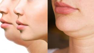 how to get perfect jaw line