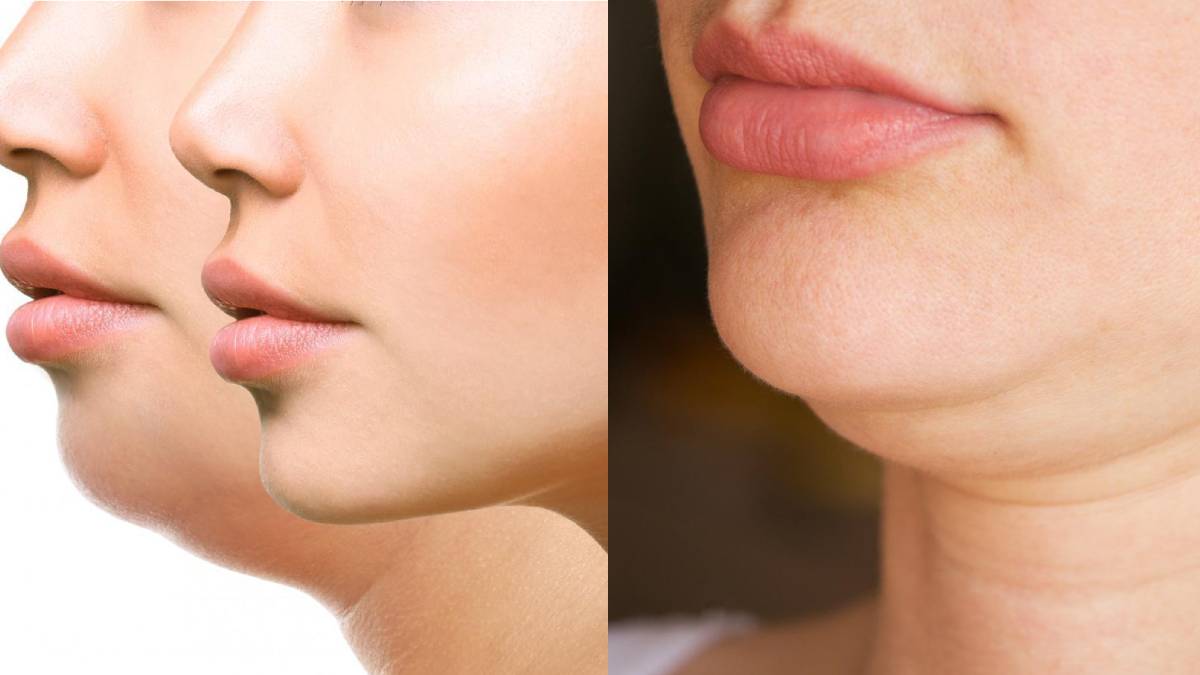 how to get perfect jaw line