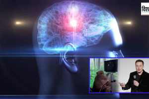 neuralink chip in human brain