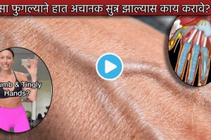 Video Swollen Veins In Hand Cause Swelling Pain In Nerves Therapist Suggest Nerve Flossing Technique Check How To Do