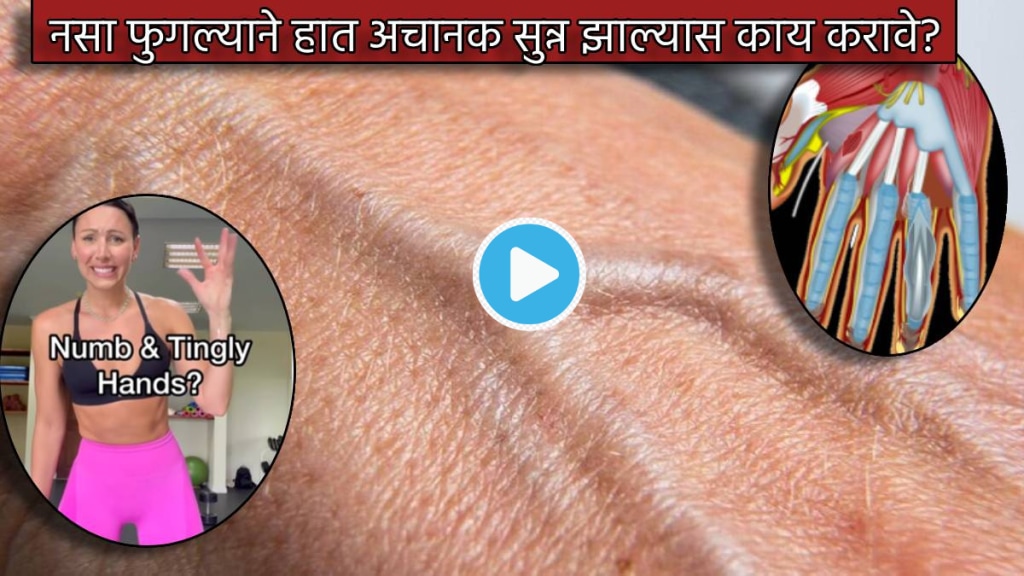 Video Swollen Veins In Hand Cause Swelling Pain In Nerves Therapist Suggest Nerve Flossing Technique Check How To Do