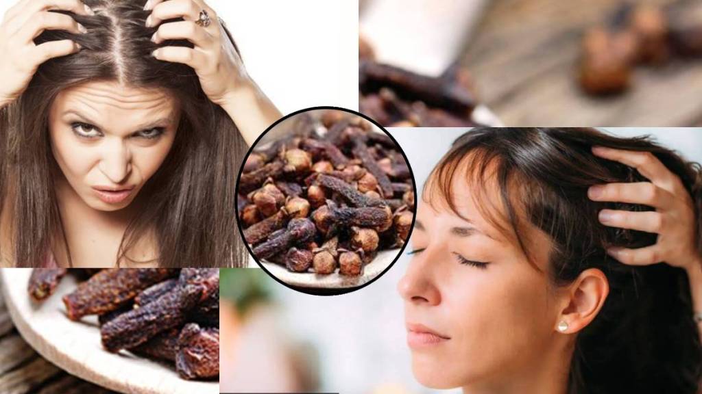 Benefits of Clove for Hair and Ways to Use It
