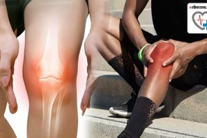 high uric acid levels caused gout