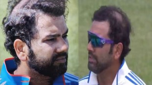 Rohit Sharma's hair fell due to worry about Leadership Pressure of fans gave Hair transplant advice