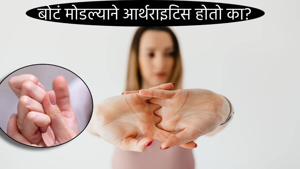 Does Knuckle Cracking Cause Arthritis you Will Think About It Next Time You Flex Hands Health News Bones Strength