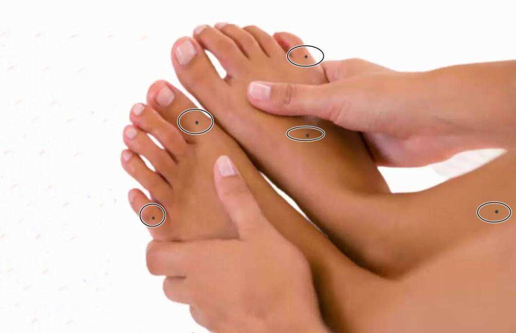 moles-on-leg