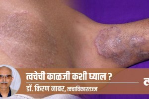 skin disease, health, ringworm