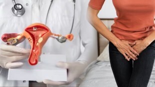 Vaginal health