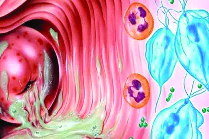 योनीमार्गाच्या आरोग्याविषयी महिलांमध्ये अनेक गैरसमज आहेत. Vaginal health म्हणजेच योनीमार्गाच्या आरोग्याकडे महिलाही फारसं लक्ष देत नाहीत.
