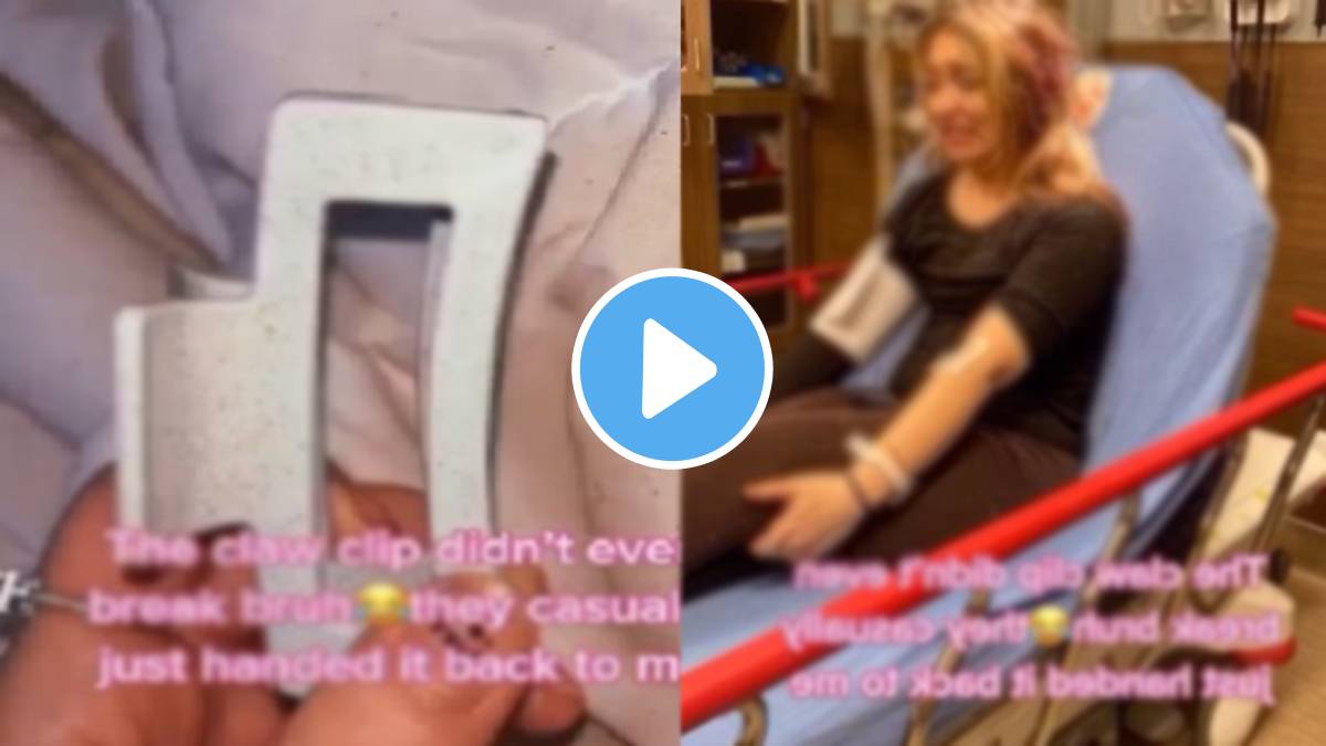 plastic hair claw clip almost took woman life ended up in her skull