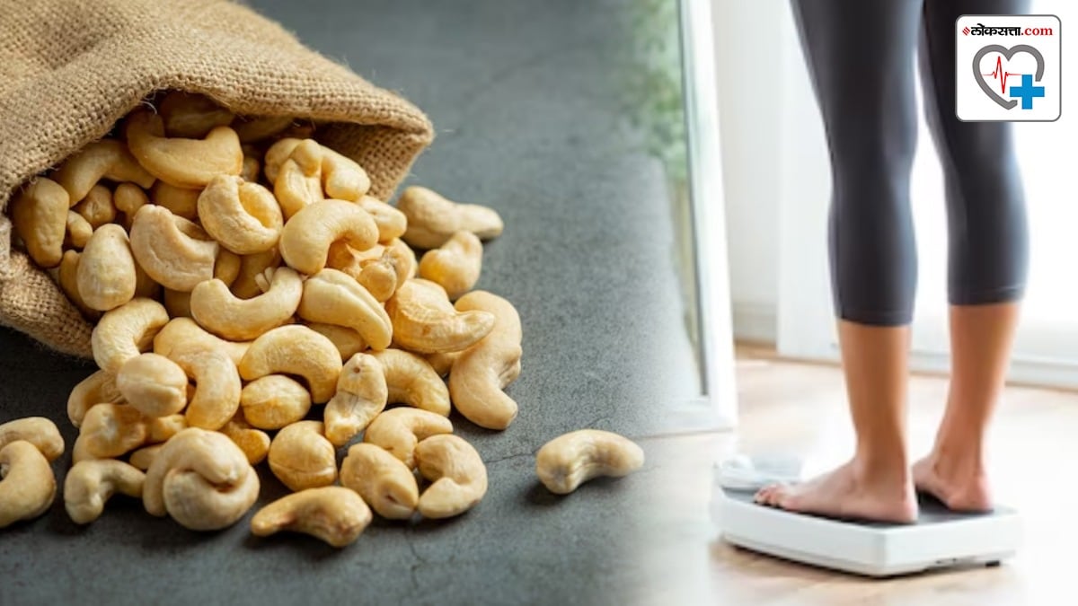 eating cashews can cause weight gain read what Dietitian said