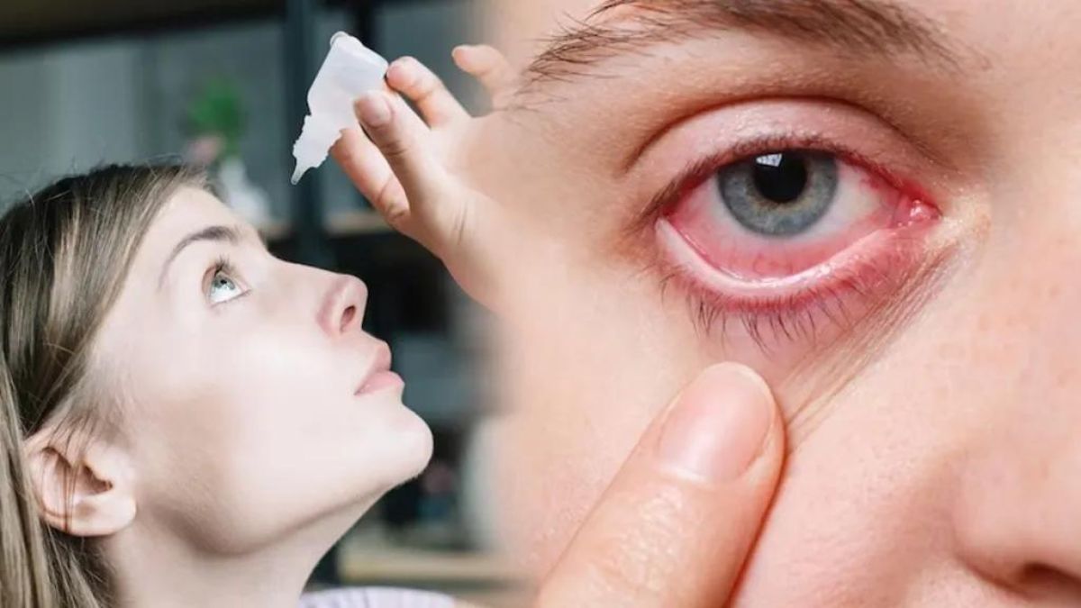 eye-disease