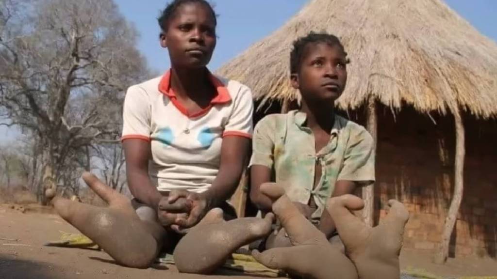 ostrich people mystery vadoma tribe africa deformed feet like bird marriage ban in others group