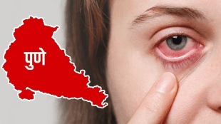 500 conjunctivitis patients every day pune
