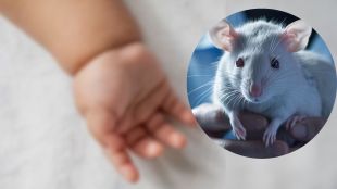 baby found with nearly 50 rat bites
