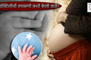 नवजात चिमुकलीची बोटं बघून कुटुंबाला आश्चर्याचा धक्का! ‘पॉलीडॅक्टिली’ स्थिती व त्याचे उपचार काय? Baby Girl With 26 Fingers and Toes Family Shocked Started Worshipping Doctor Explain Polydactyly Condition Signs Treatment