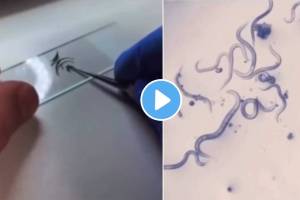 तुम्हालाही नखं खाण्याची सवय आहे का? मग तुम्ही हा Video एकदा नक्की बघा…. With the help of a microscope it has been shown how many germs are present in the nails