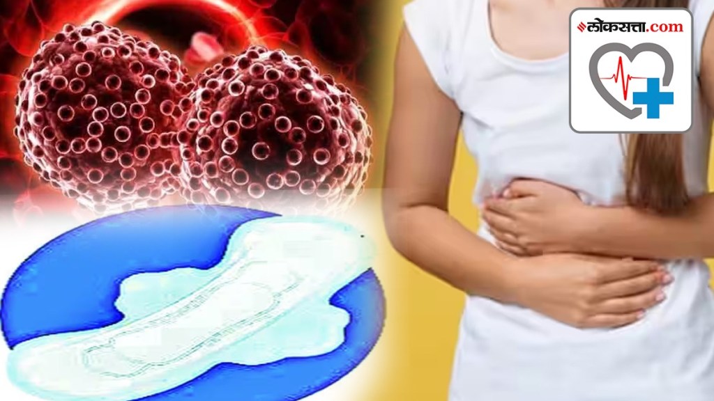 Sanitary pads can cause Cancer