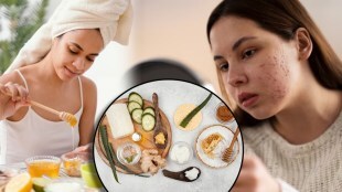 Skin Care Tips Stubborn acne scars