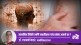 mental states skin disorders related