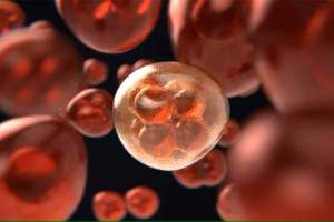 accurate diagnosis of gallbladder cancer