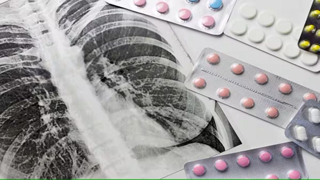 tuberculosis drugs difficult to available till december