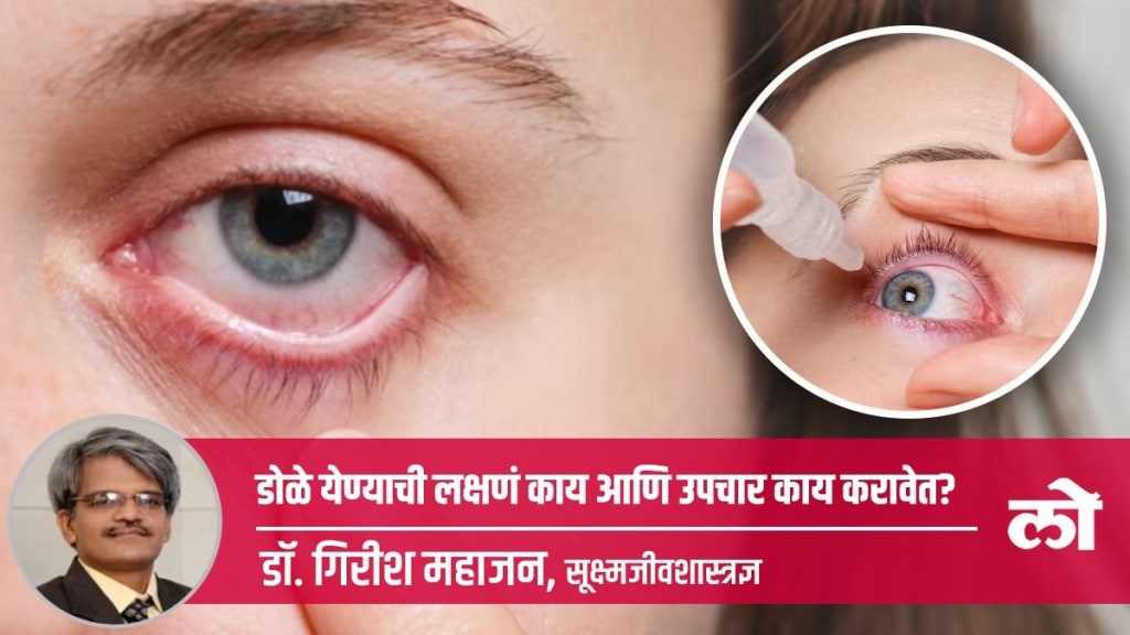 Conjunctivitis