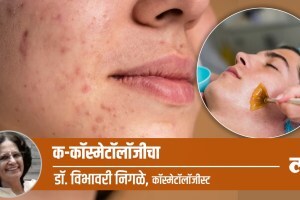 Health Special: मुरुमांचे डाग आणि व्रण पूर्णपणे जातात का? pimples treatment