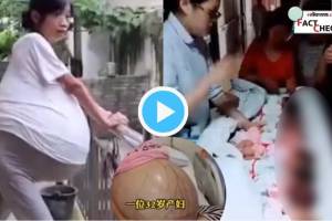 Women Giving Birth to 9 Babies Reality Video Huge Belly With 40 Kg Muscles Due To Overian Cancer Liver Issue Sad Facts Viral