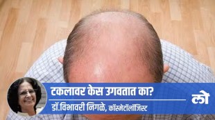 does hair grow on bald head in marathi, how to grow hair on bald head in marathi, hair treatment on bald head in marathi