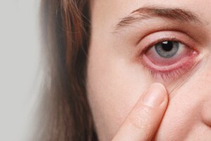 Maharashtra outbreak conjunctivitis under control mumbai