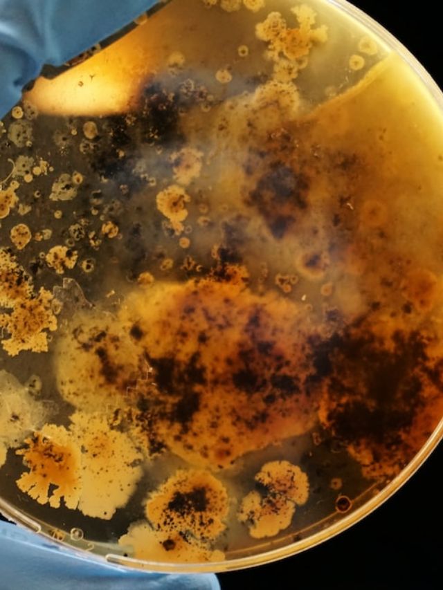Health Tips: bacteria (unsplash)