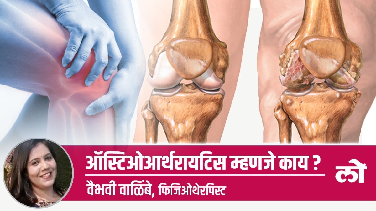 What is osteoarthritis