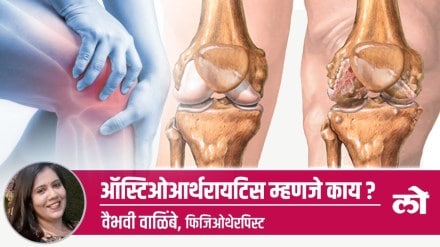 What is osteoarthritis