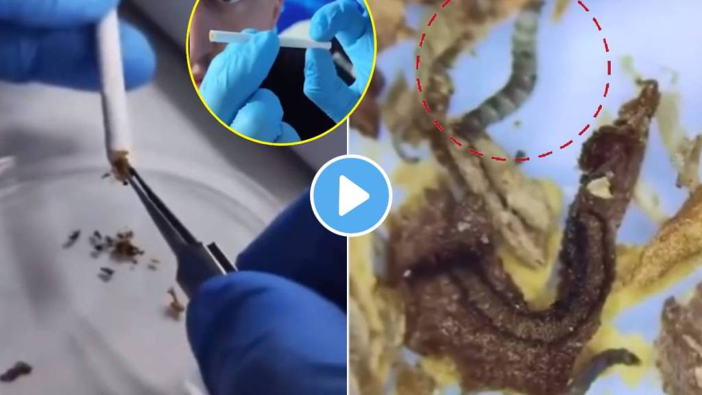 man shows worms in cigarette bidi under microscope with tambaku