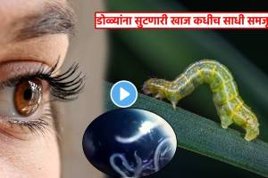 60 Alive Worms Removed From Womens Eyes After She Complains Itching In Eyes Doctor Tells How Worm Reached In Eyes Shocking