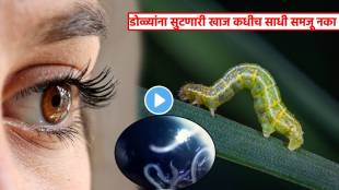 60 Alive Worms Removed From Womens Eyes After She Complains Itching In Eyes Doctor Tells How Worm Reached In Eyes Shocking