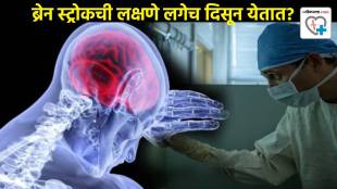 Can brain strokes happen under 40 Do they always show symptoms of Brain Stroke Primarily Health Expert Explain Cause of Paralysis