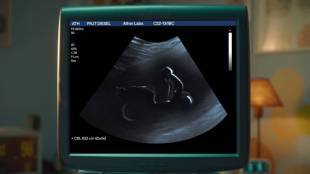 Ather teases upcoming family electric scooter Rizta With The video Of ultrasonography ultrasound monitor